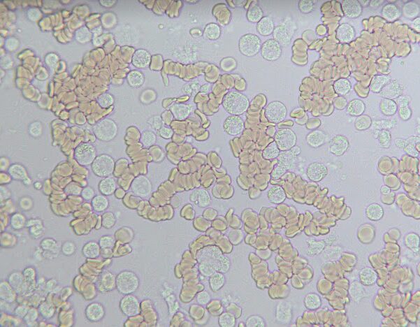 Codocytes Under Microscope The White Blood Cells M5L1 - Living Ground Courses